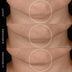 Lancome Rénergie H.P.N. 300 Peptides Crème Anti-Âge Haute-Performance Recharge 50 Ml